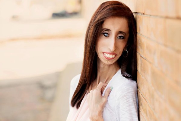 亲子讨论区 教养教育 小学生 美国女孩lizzie velasquez,今年25岁